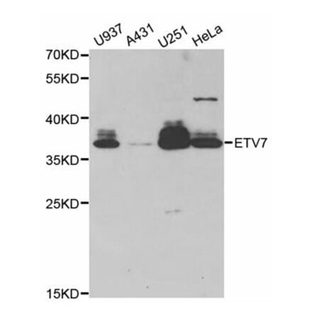 Western blot - ETV7 antibody from Signalway Antibody (38781) - Antibodies.com