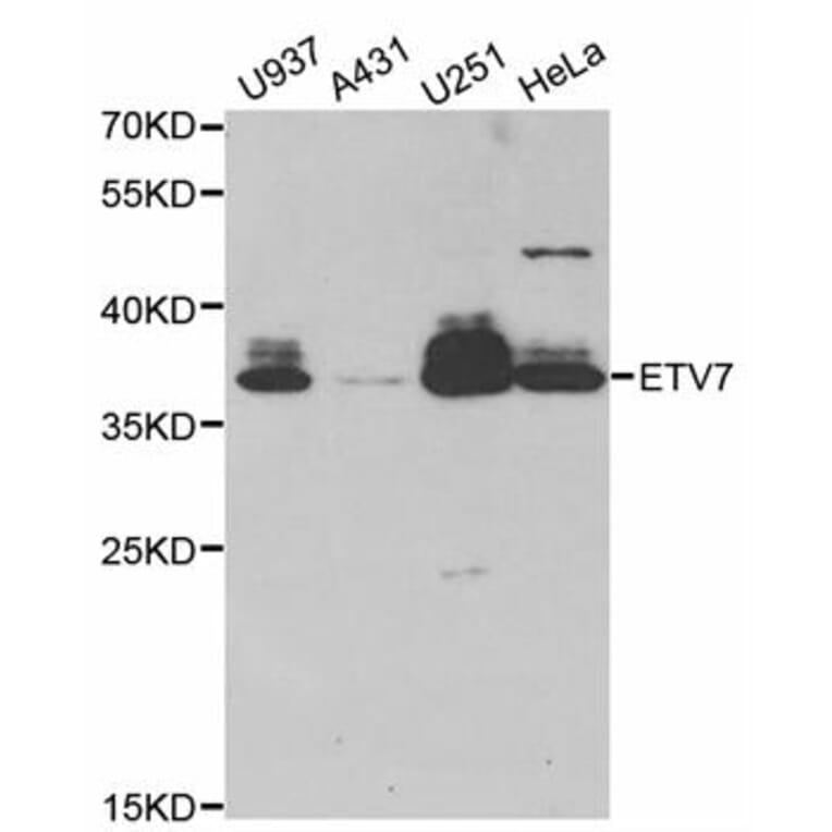 Western blot - ETV7 antibody from Signalway Antibody (38781) - Antibodies.com