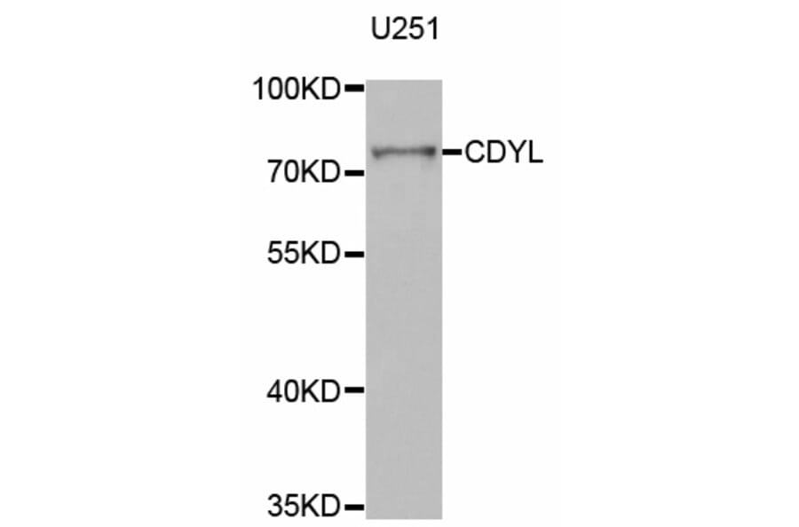 Western blot - CDYL antibody from Signalway Antibody (38784) - Antibodies.com