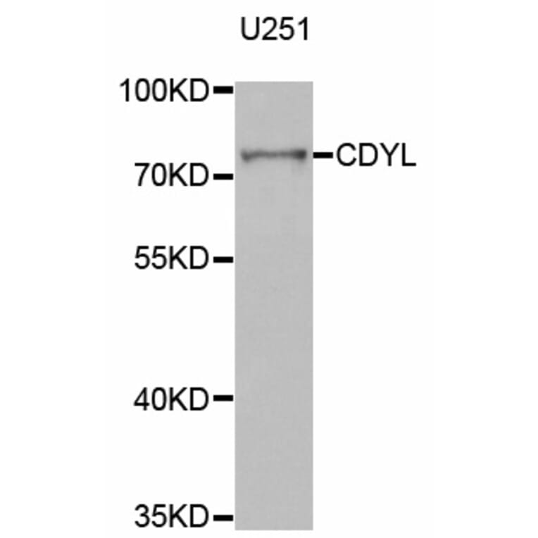 Western blot - CDYL antibody from Signalway Antibody (38784) - Antibodies.com