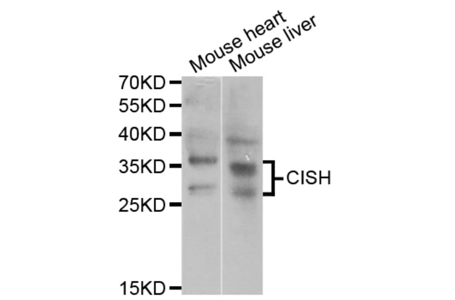 Western blot - CISH antibody from Signalway Antibody (38795) - Antibodies.com