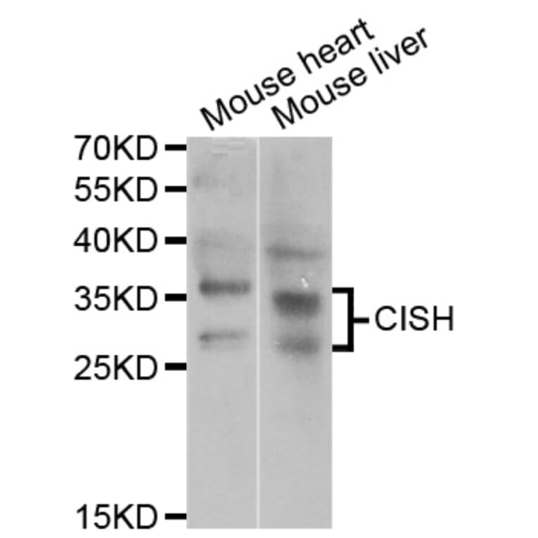 Western blot - CISH antibody from Signalway Antibody (38795) - Antibodies.com