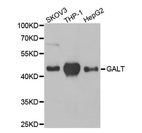 Western blot - GALT antibody from Signalway Antibody (38799) - Antibodies.com