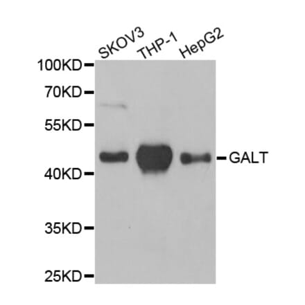Western blot - GALT antibody from Signalway Antibody (38799) - Antibodies.com
