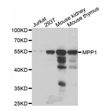 Western blot - MPP1 antibody from Signalway Antibody (38804) - Antibodies.com