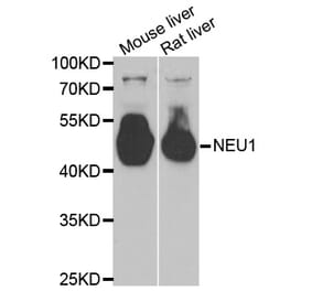 Western blot - NEU1 antibody from Signalway Antibody (38805) - Antibodies.com