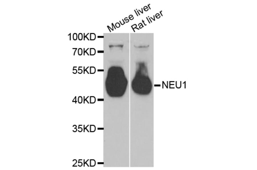 Western blot - NEU1 antibody from Signalway Antibody (38805) - Antibodies.com