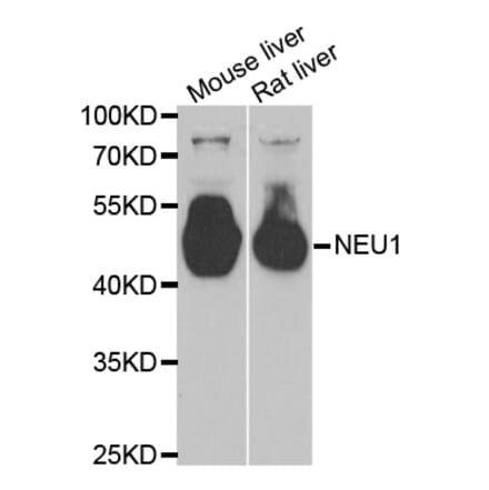 Western blot - NEU1 antibody from Signalway Antibody (38805) - Antibodies.com