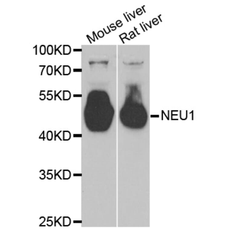 Western blot - NEU1 antibody from Signalway Antibody (38805) - Antibodies.com