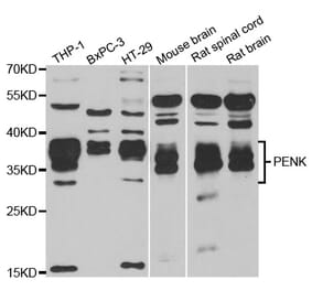 Western blot - PENK antibody from Signalway Antibody (38808) - Antibodies.com