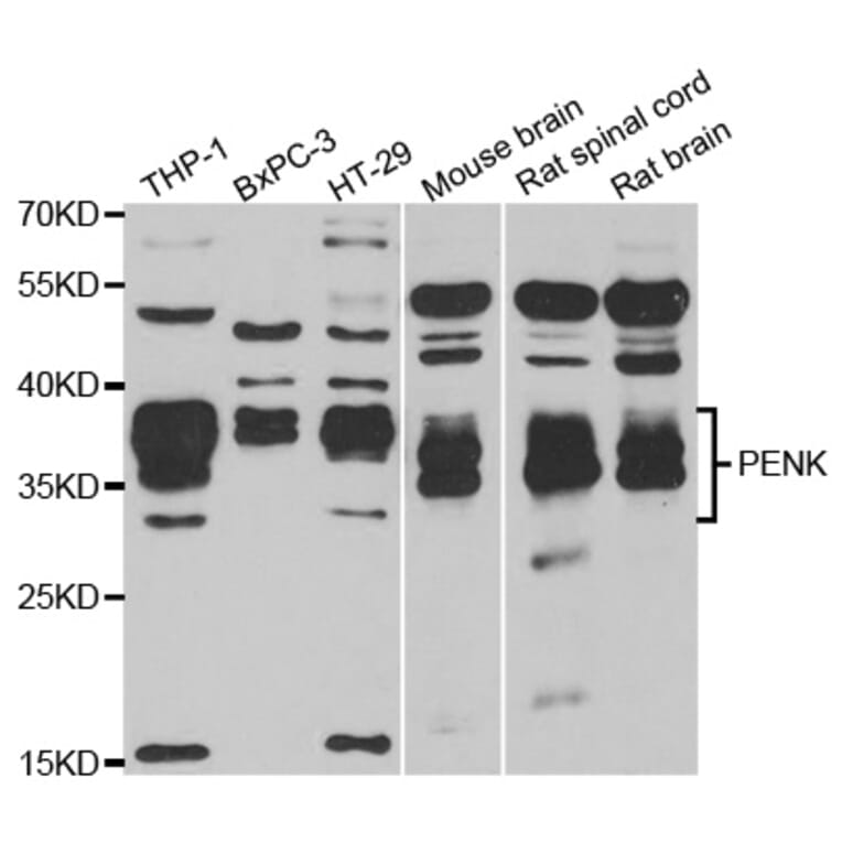 Western blot - PENK antibody from Signalway Antibody (38808) - Antibodies.com