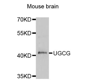 Western blot - UGCG antibody from Signalway Antibody (38820) - Antibodies.com