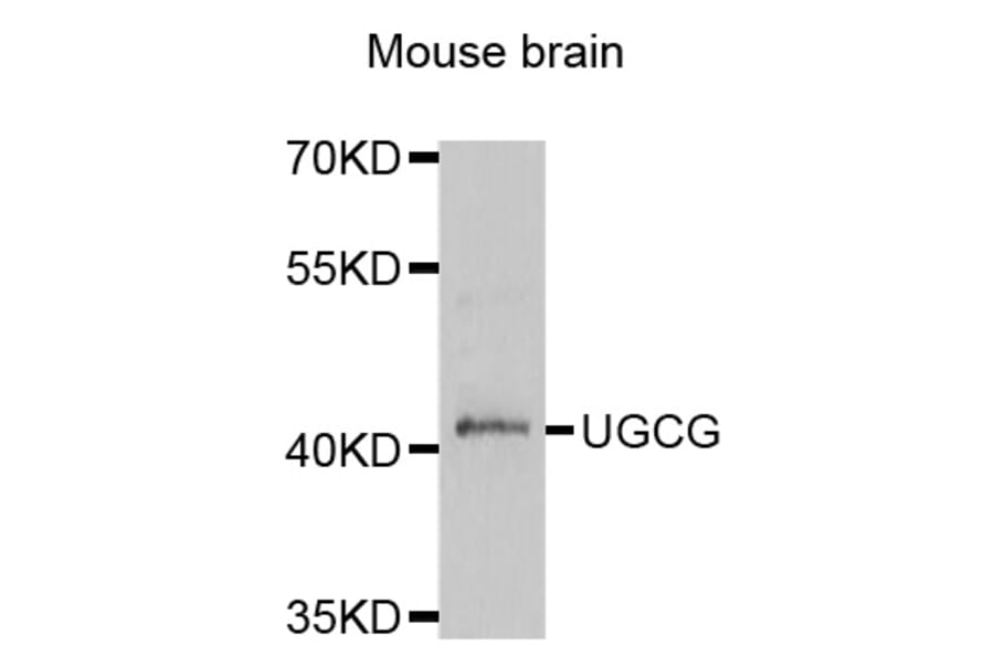 Western blot - UGCG antibody from Signalway Antibody (38820) - Antibodies.com
