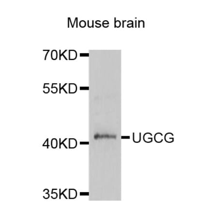 Western blot - UGCG antibody from Signalway Antibody (38820) - Antibodies.com