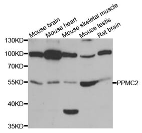 Western blot - PDP1 antibody from Signalway Antibody (38831) - Antibodies.com