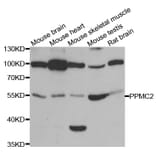 Western blot - PDP1 antibody from Signalway Antibody (38831) - Antibodies.com