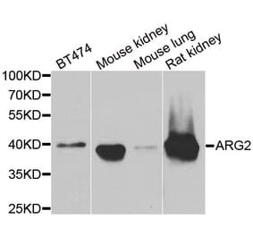 Western blot - ARG2 antibody from Signalway Antibody (38842) - Antibodies.com