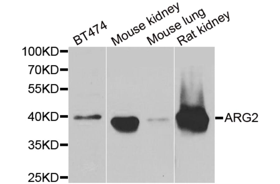 Western blot - ARG2 antibody from Signalway Antibody (38842) - Antibodies.com
