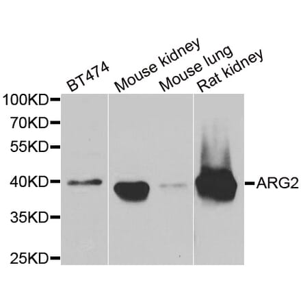 Western blot - ARG2 antibody from Signalway Antibody (38842) - Antibodies.com