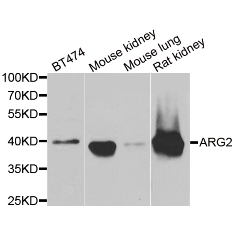 Western blot - ARG2 antibody from Signalway Antibody (38842) - Antibodies.com