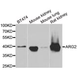 Western blot - ARG2 antibody from Signalway Antibody (38842) - Antibodies.com