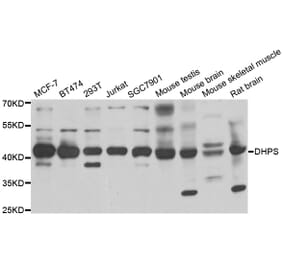 Western blot - DHPS antibody from Signalway Antibody (38852) - Antibodies.com