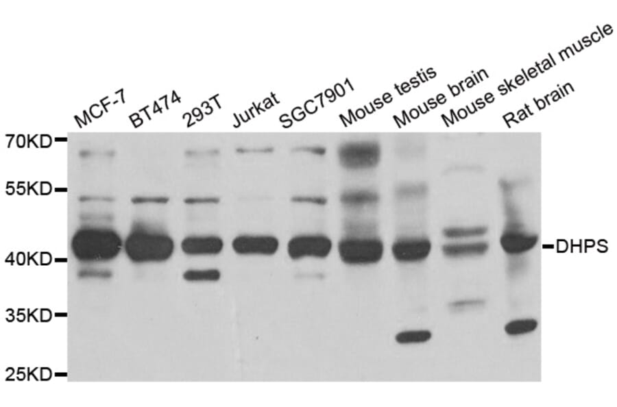 Western blot - DHPS antibody from Signalway Antibody (38852) - Antibodies.com