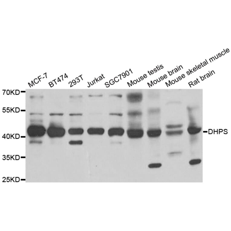 Western blot - DHPS antibody from Signalway Antibody (38852) - Antibodies.com