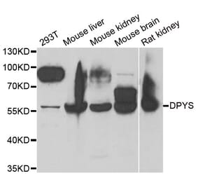 Western blot - DPYS antibody from Signalway Antibody (38853) - Antibodies.com