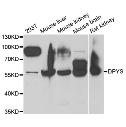 Western blot - DPYS antibody from Signalway Antibody (38853) - Antibodies.com