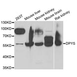 Western blot - DPYS antibody from Signalway Antibody (38853) - Antibodies.com