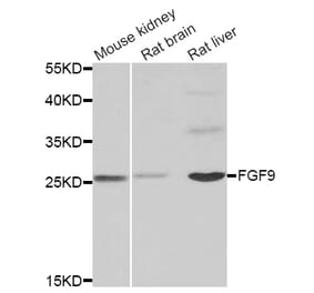 Western blot - FGF9 antibody from Signalway Antibody (38859) - Antibodies.com