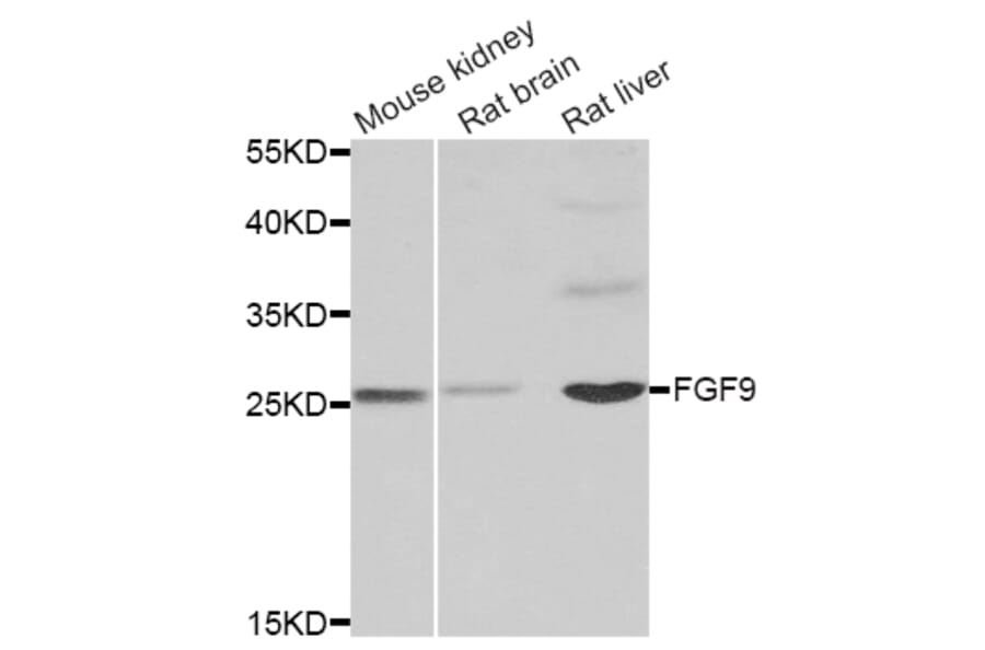 Western blot - FGF9 antibody from Signalway Antibody (38859) - Antibodies.com