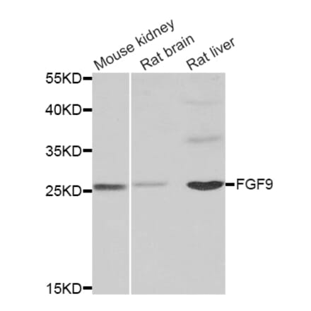 Western blot - FGF9 antibody from Signalway Antibody (38859) - Antibodies.com