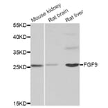 Western blot - FGF9 antibody from Signalway Antibody (38859) - Antibodies.com