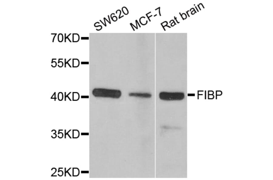 Western blot - FIBP antibody from Signalway Antibody (38914) - Antibodies.com