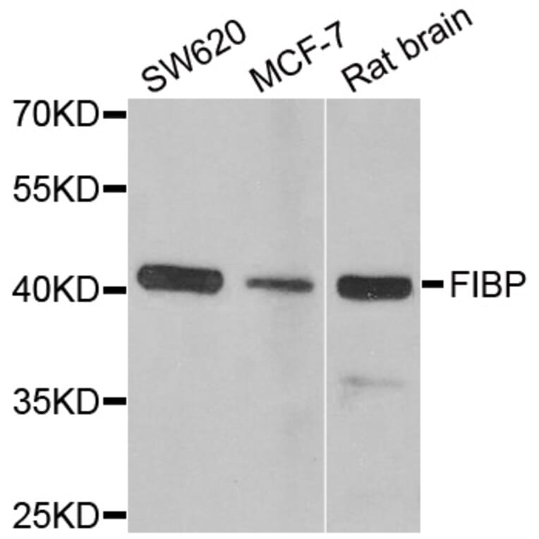 Western blot - FIBP antibody from Signalway Antibody (38914) - Antibodies.com