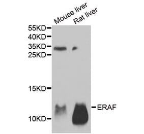 Western blot - AHSP antibody from Signalway Antibody (38941) - Antibodies.com