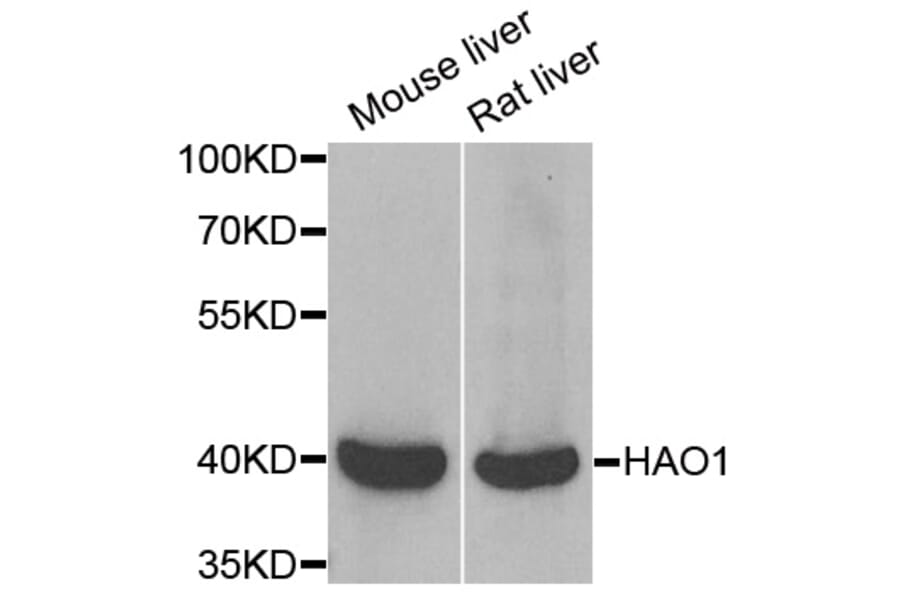 Western blot - HAO1 antibody from Signalway Antibody (38946) - Antibodies.com