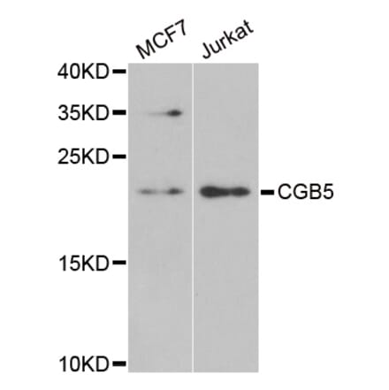 Western blot - CGB5 antibody from Signalway Antibody (38958) - Antibodies.com