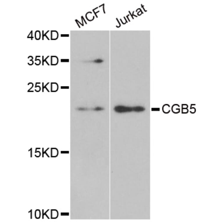 Western blot - CGB5 antibody from Signalway Antibody (38958) - Antibodies.com