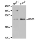 Western blot - CGB5 antibody from Signalway Antibody (38958) - Antibodies.com