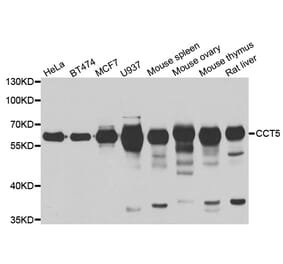 Western blot - CCT5 antibody from Signalway Antibody (39001) - Antibodies.com