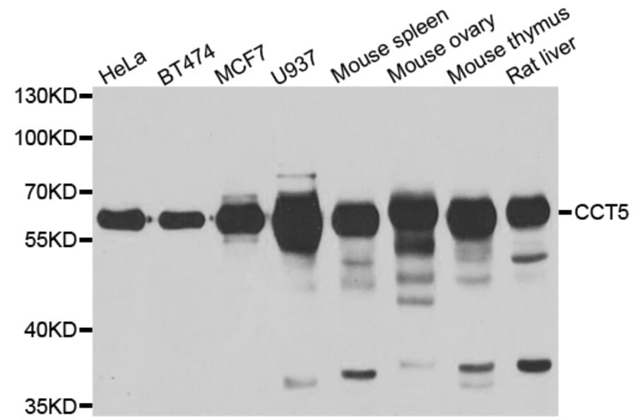 Western blot - CCT5 antibody from Signalway Antibody (39001) - Antibodies.com