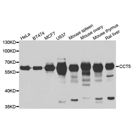 Western blot - CCT5 antibody from Signalway Antibody (39001) - Antibodies.com