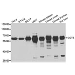 Western blot - CCT5 antibody from Signalway Antibody (39001) - Antibodies.com