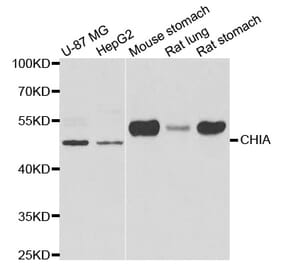 Western blot - CHIA antibody from Signalway Antibody (39006) - Antibodies.com