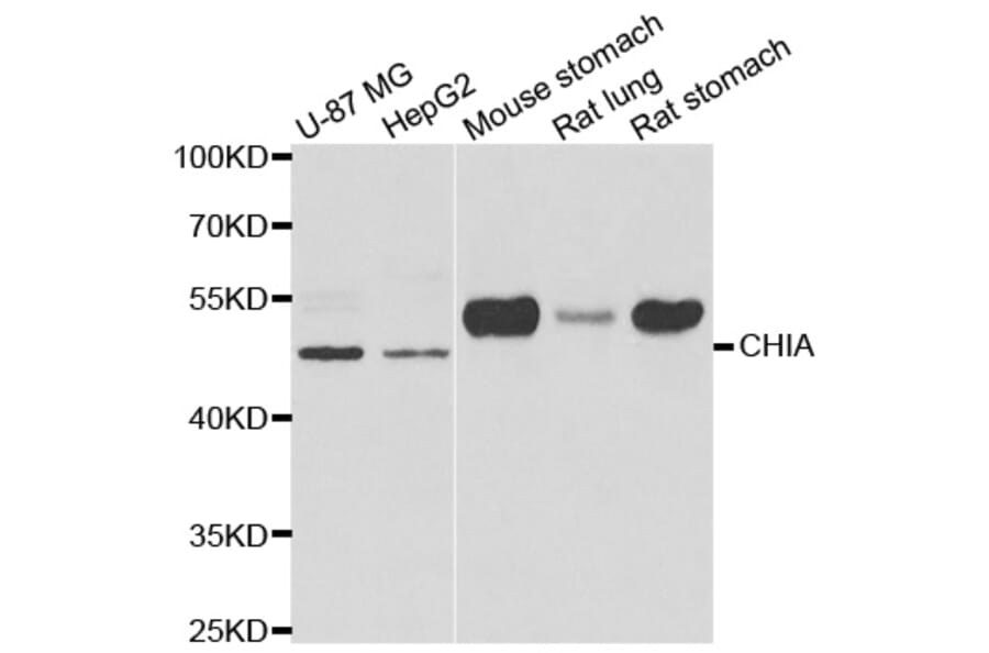 Western blot - CHIA antibody from Signalway Antibody (39006) - Antibodies.com