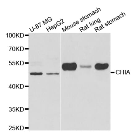 Western blot - CHIA antibody from Signalway Antibody (39006) - Antibodies.com