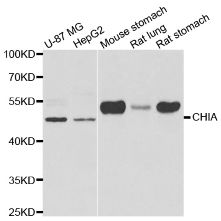 Western blot - CHIA antibody from Signalway Antibody (39006) - Antibodies.com